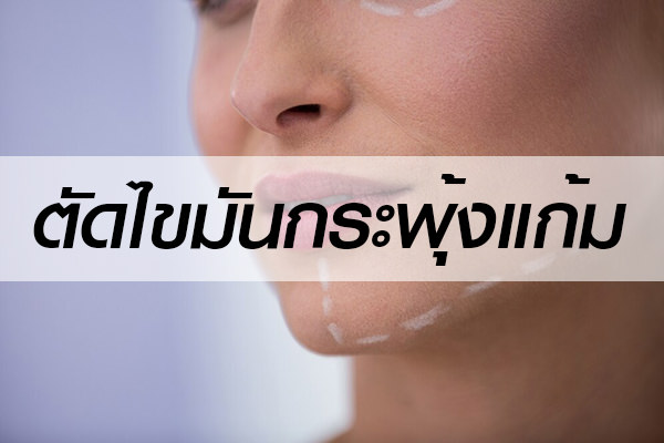 ศัลยกรรม-ตัดไขมันกระพุ้งแก้ม